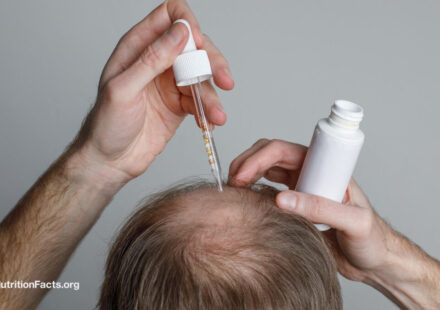 The Benefits and Risks of Hair Loss Drugs